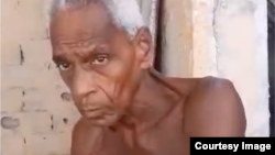 Valdés Pedroso, con múltiples problemas de salud, sobrevive en precarias condiciones higiénico sanitarias.