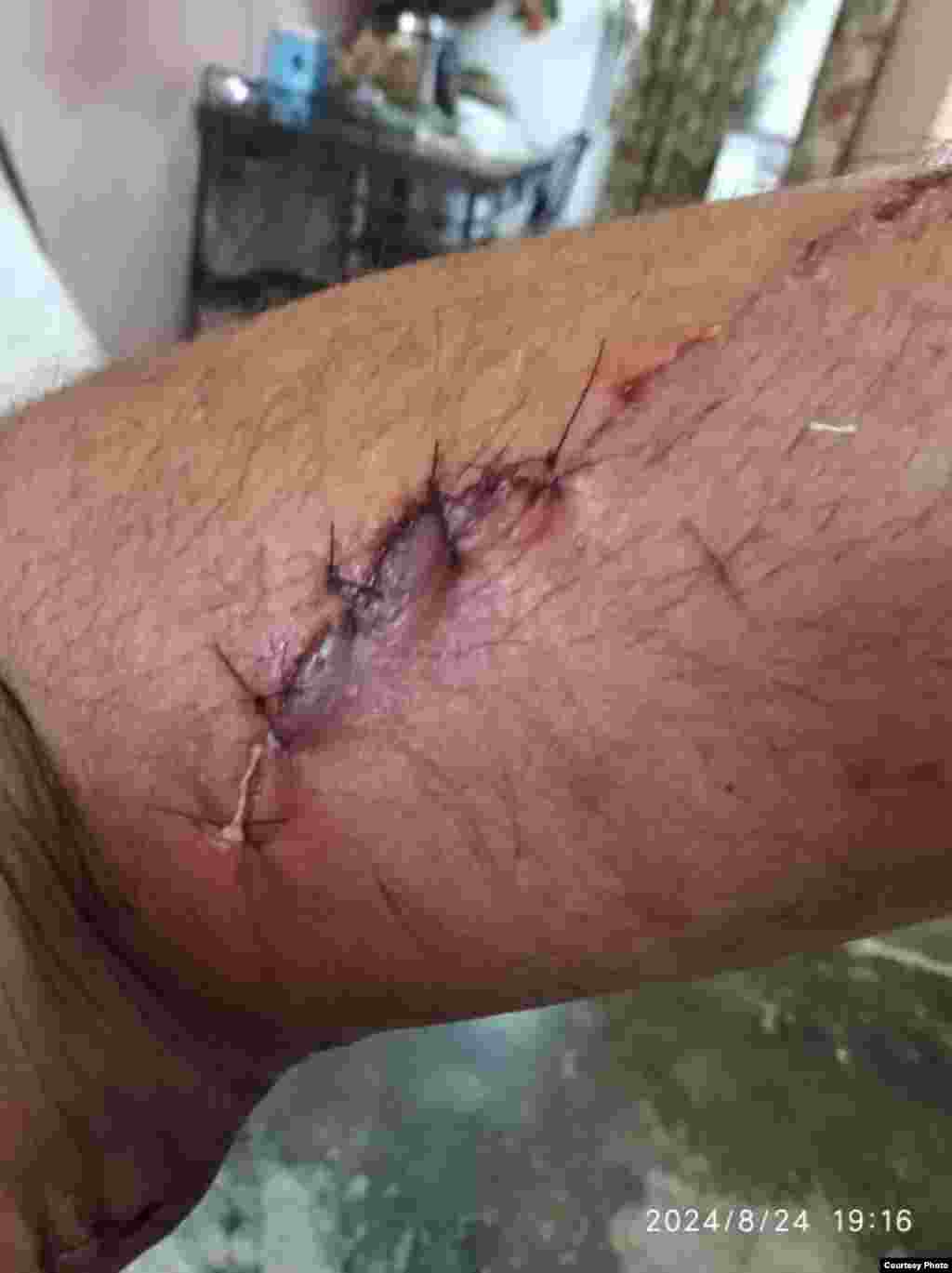 Leonel Murgado resultó herido al tratar de salvar a su sobrino, que falleció por apuñalamiento en el hecho violento ocurrido el 22 de agosto de 2024 en Bauta, provincia Artemisa.