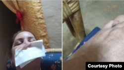 Diasniurka Salcedo muestra agresiones (Tomado de su perfil de Facebook)