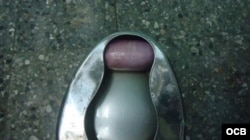 Una de las cásulas expulsadas por el viajero que trasladaba la droga.