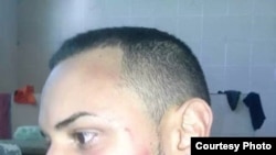 Migrantes cubanos fueron golpeados mientras realizaban huelga de hambre