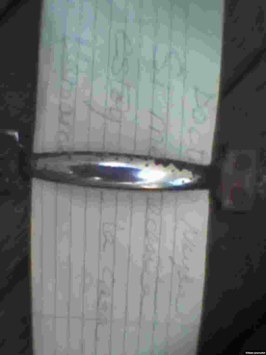 Yosmel Martínez Corcho desde Quemado de Güines reporta situación de la salud