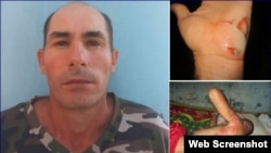 El periodista independiente Osvaldo Landín Baños fue atropellado por la policía durante su arresto. (Foto: ICLEP)