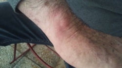 José Díaz Silva cuenta los malos tratos recibidos durante su detención José Díaz Silva cuenta los malos tratos recibidos durante su detención